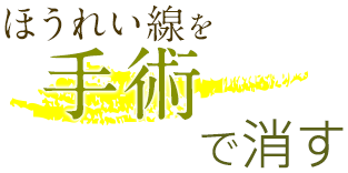 ほうれい線を手術で消す